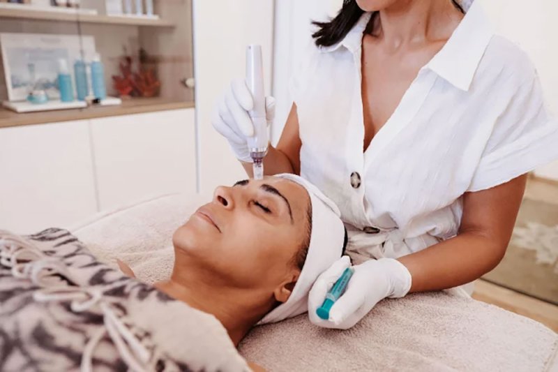 Treatwell.at | Strahlendschön