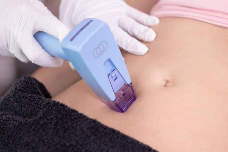 Kosmedics Graz - Dr. Karin Migglautsch
